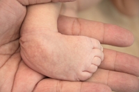 Congenital Foot Problems Can Be Corrected
